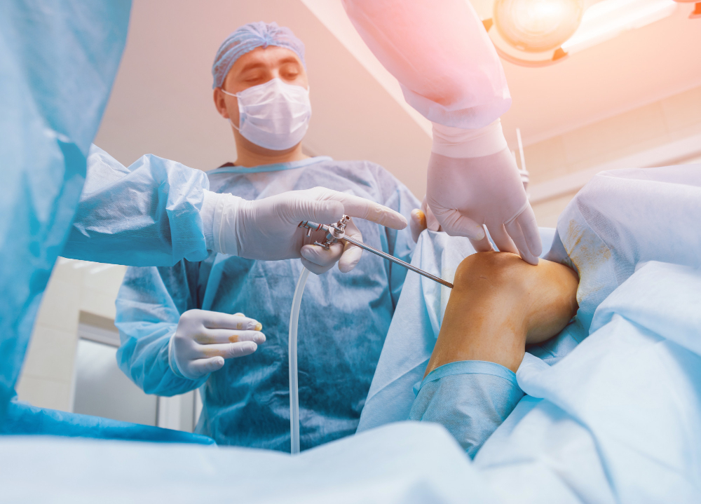 Arthroscopy Surgery