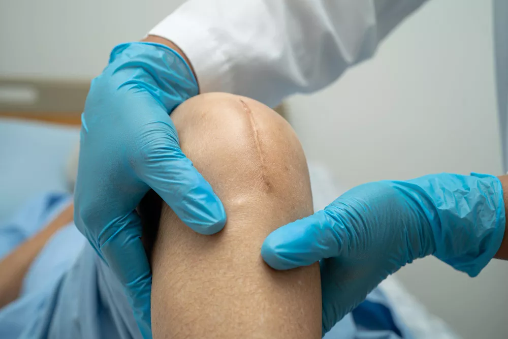 Joint Replacement Surgery